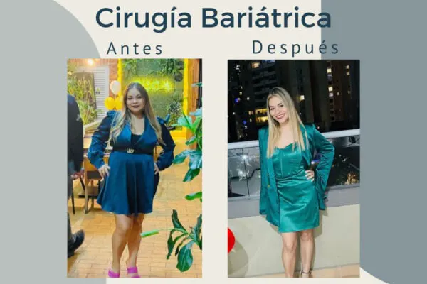 Img-Dr_Adolfo_Uribe-Antes_Y_Despues-2