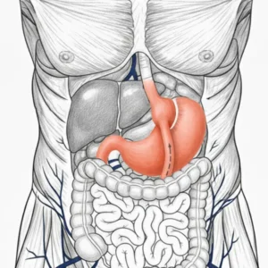 img-gastric-bypass-medellin-1